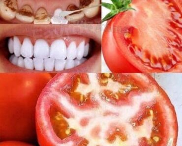 Brighten your smile naturally: Tomato teeth whitening