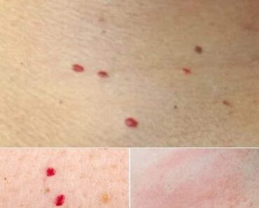 If you spot these red dots on your skin, here’s what they mean. Check the first comment ⤵️